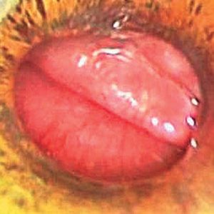Edge of Epiglotis