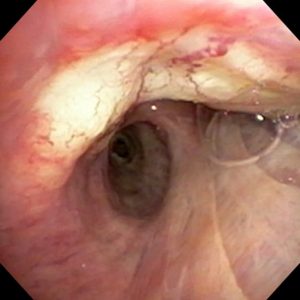 Ilha Vascular