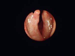Endoscopia veterinária com prótese laríngea Stening®